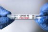 COVID-19-PCR-Test